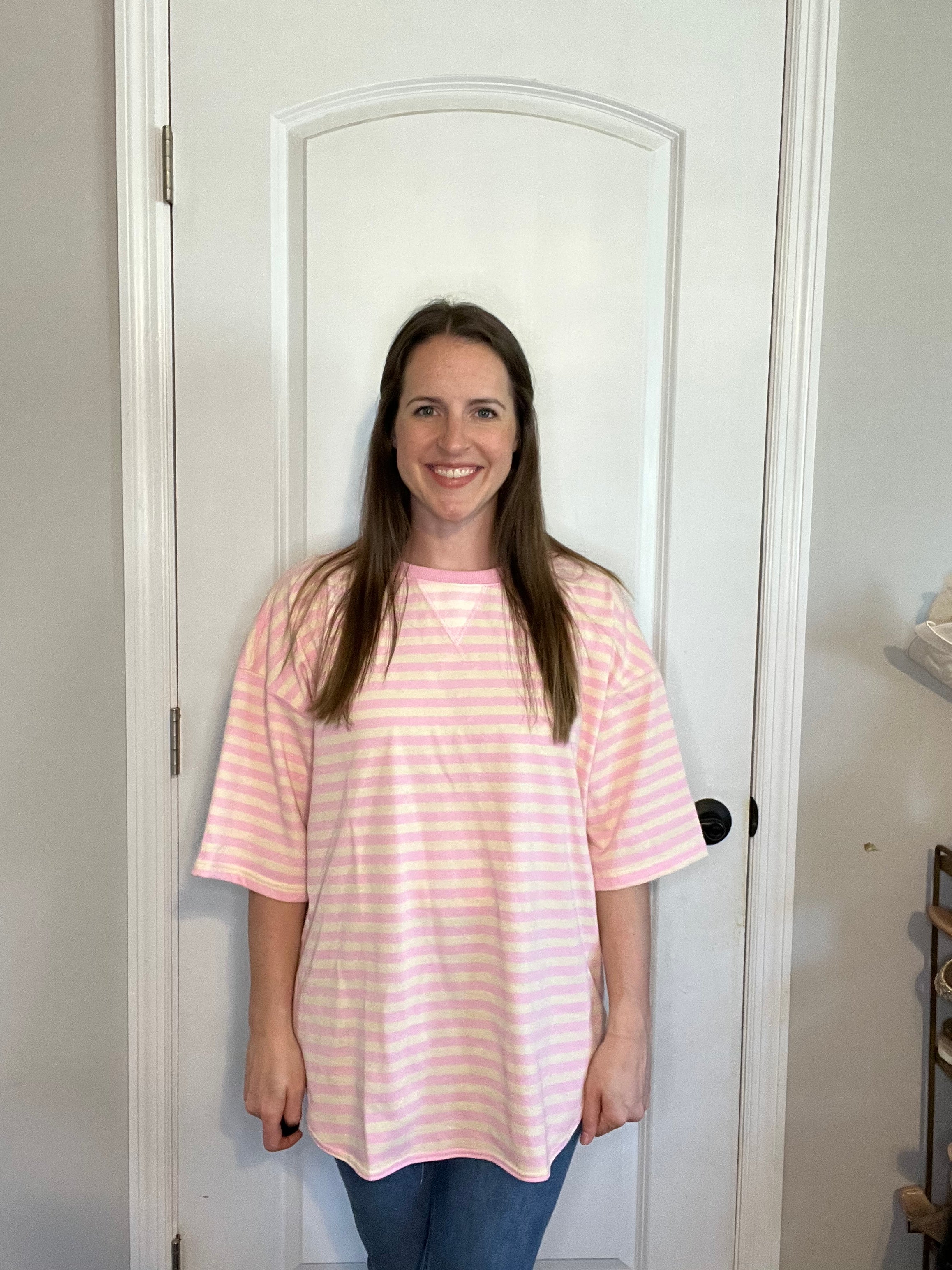 Striped Oversized Short Sleeve Top